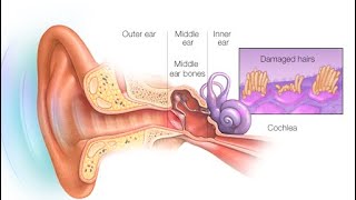 The Villages Ear Todd Wilfong Talks Tinnitus. The Villages Ear, Villages FL 352-753-3033
