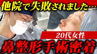 【鼻整形】20代女性の修正手術に密着| 術後1ヶ月までのダウンタイムをお届け