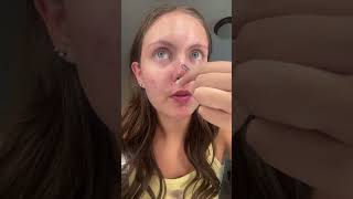 Part 11 #pimplepatch #pimple #satisfying #asmr #acne