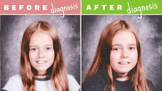 How I Got Diagnosed - Inflammatory Bowel Disease | Let