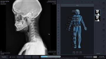 Voyance Medical Software Demo