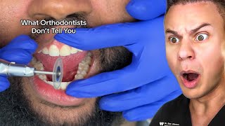 What Dentists Don't Tell You About Your Teeth!