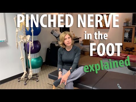 Pinched-Nerve-in-the-Foot-explained-by-Irvine-Posture-an