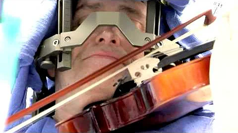 Deep Brain Stimulation - Awake Surgery - Mayo Clinic - DayDayNews