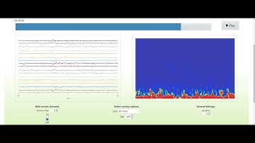 Frequency Analysis Spectrogram of EEG Signal