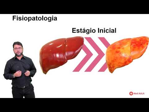 Vidéo: Hépatite Alcoolique: Causas, Síntomas Y Diagnóstico