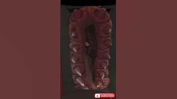 LethalCompany Fake Fire Exit😂😂