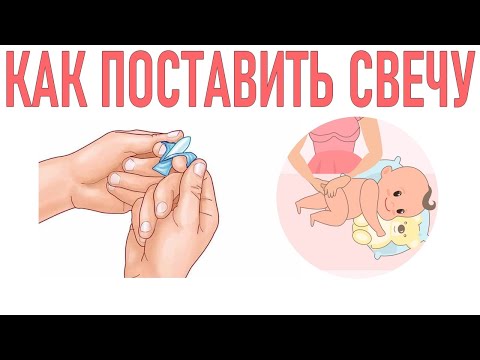 КАК ПРАВИЛЬНО ПОСТАВИТЬ СВЕЧКУ РЕБЕНКУ | Последовательность действий при постановке ребенку свечки
