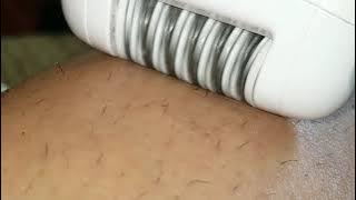 Up close epilator