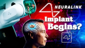 Ai Merge Human Consciousness: Human-Computer Integration by 2030? (Neuralink) | Rendition Media