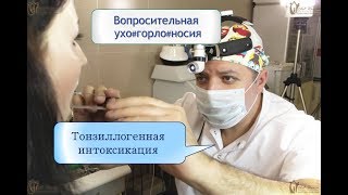 Тонзиллогенная интоксикация