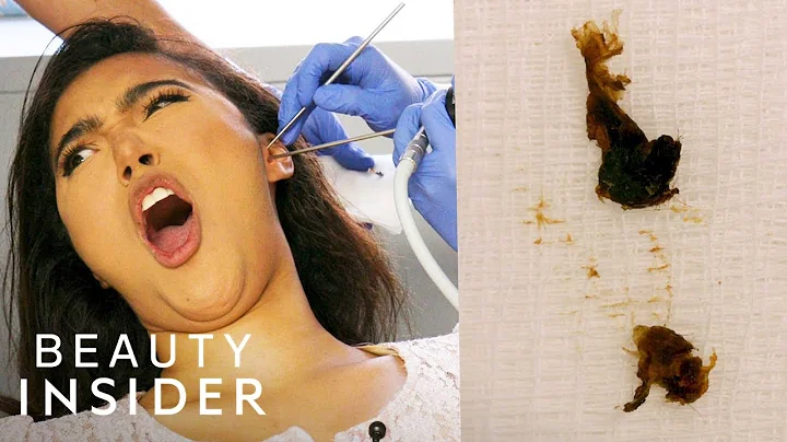 How Earwax Is Professionally Extracted | Beauty Explorers | Insider Beauty - DayDayNews