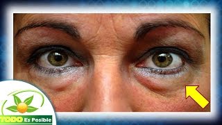 Las para bolsas médicas ojos razones de los