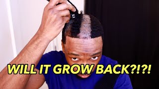 CUTTING MY HAIR TRANSPLANT BALD!