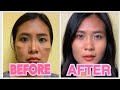 CONTOUR AND CONCEALER on my face |JIKKy