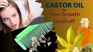 Healthy Hair : Castor Oil for Dandruff and Hair Growth