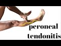 Peroneal Tendonitis
