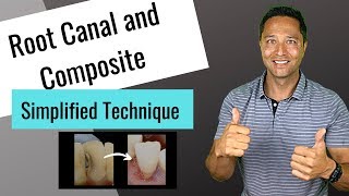 Dr. Mahmoud Nasani Restoration Of Endodontically Treated Teeth