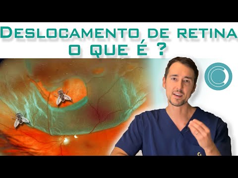 Vídeo: O que significa deslocamento em termos médicos?