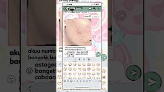 jerawat 🙁💢🫧 || #masukberanda #fakechat #whatsmock #pov #coloring #soft #aesthetic #fypシ #short #4u screenshot 5