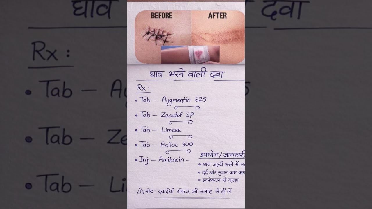 ghav Sahi karne ke liye medicine 