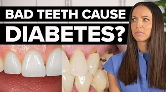 The Hidden Link Between Diabetes and Your Teeth