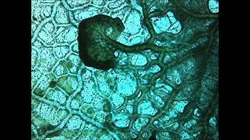 Physarum sp., Myxomycota "Slime mould exhibiting reversal of cytoplasmic streaming!"