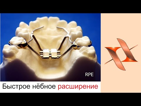 Видео: Ив Рошерын каталогийг хэрхэн яаж авах вэ