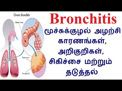 Bronchitis மூச்சுக்குழல் அழற்சி காரணங்கள், அறிகுறிகள், சிகிச்சை மற்றும் தடுத்தல்