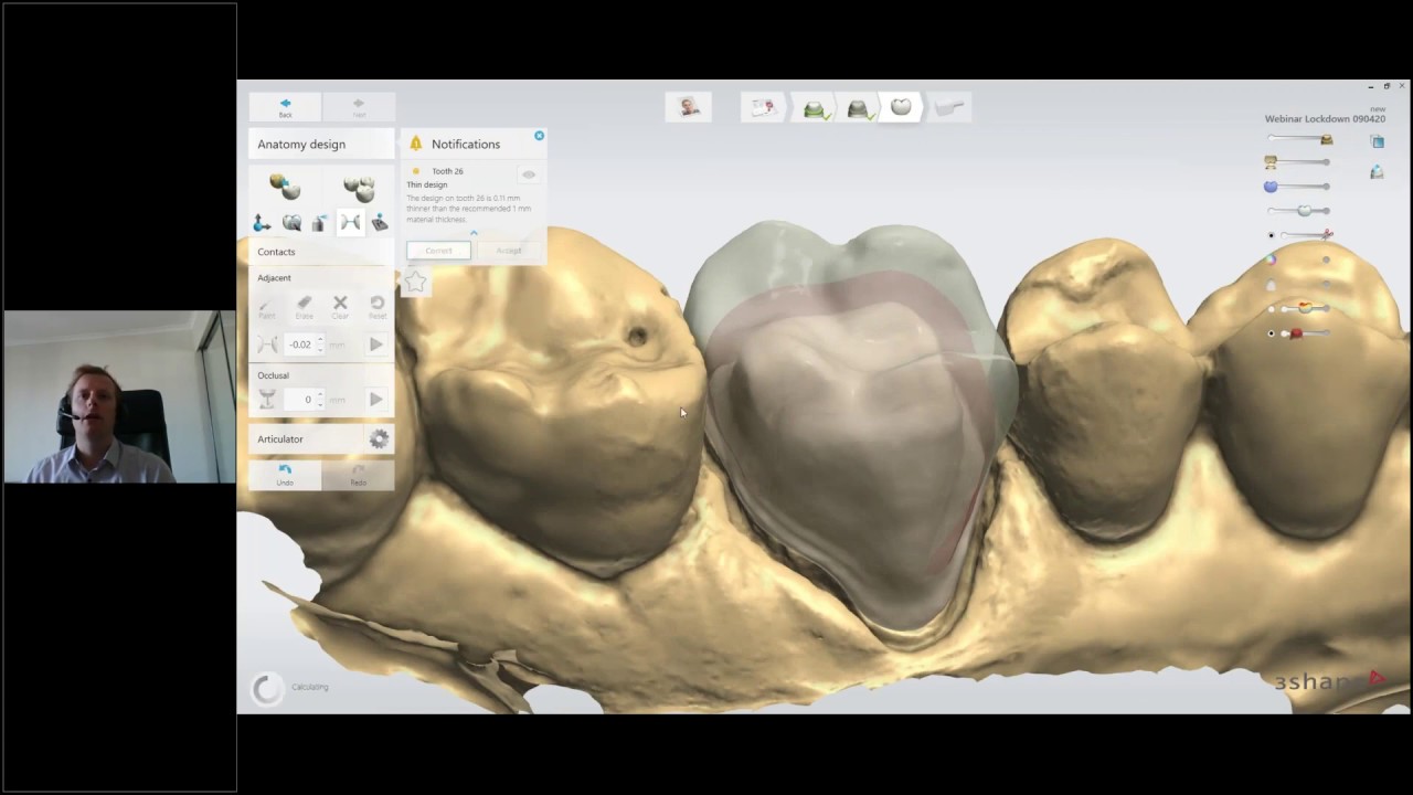 Webinar: Digital workflows for manufacturing crown and bridge restorations in clinic