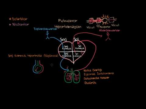 Pulmoner Hipertansiyon Semptomları ve Nedenleri (Fen Bilimleri) (Sağlık ve Tıp)