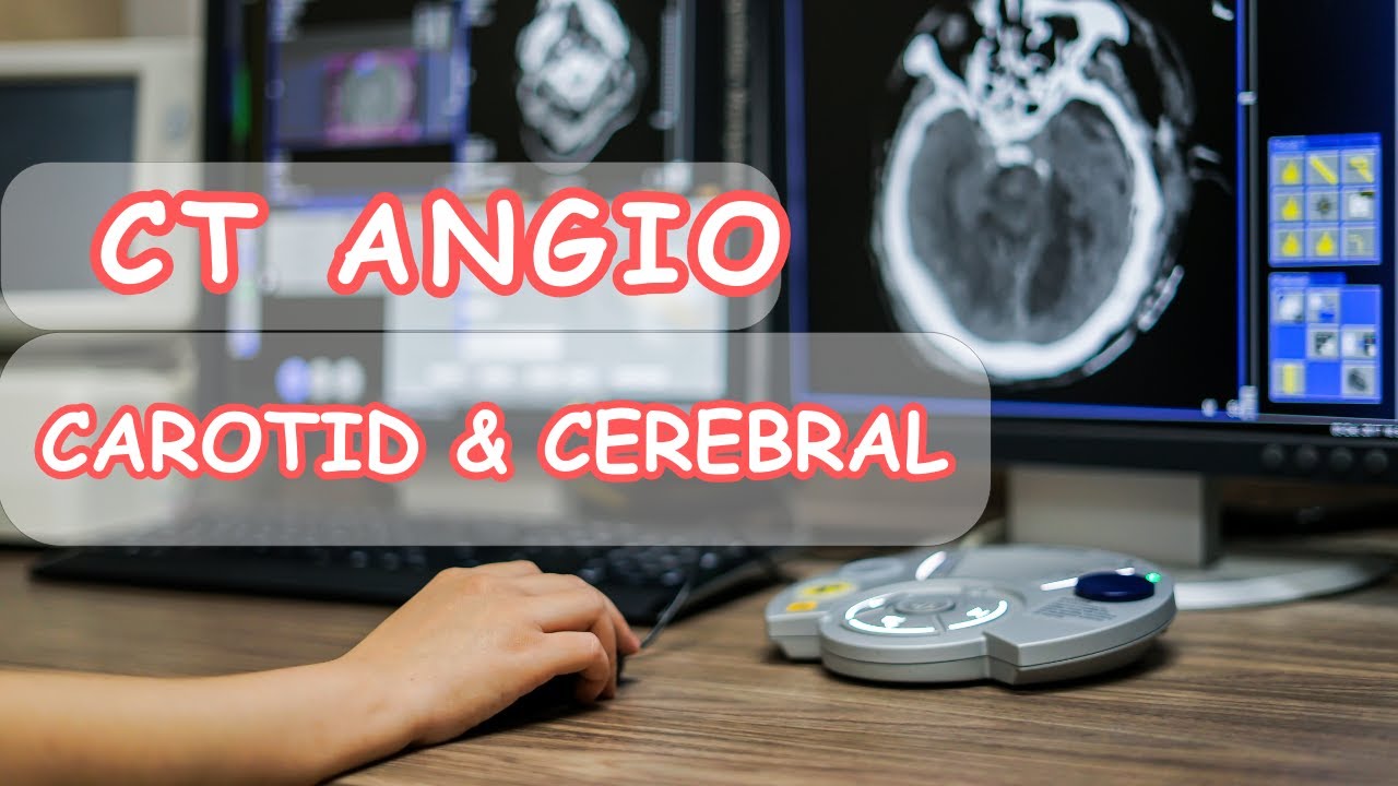Ct angiography carotid and cerebral أشعة مقطعية على شرايين الرقبة والمخ