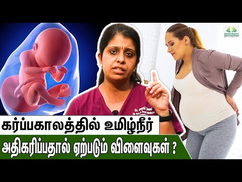 கர்ப்பகாலத்தில் உமிழ்நீர் அதிகமாக இருந்தால் என்ன செய்யவேண்டும் ? | Dr Deepthi Jammi | Pregnancy Tips