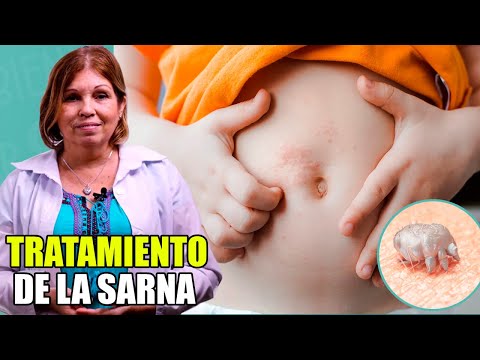 ¡Fue REVELADO!🔸Cómo curar Sarna Humana rápido ✅ Sarnilla humana Fotos 👀