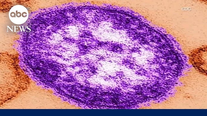 Why Measles Cases Are On The Rise And How To Keep Your Family Safe
