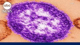 Why measles cases are on the rise and how to keep your family safe Measles Cases On The Rise In 2024