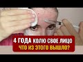 МОЙ ПУТЬ ДОМАШНИХ УКОЛОВ КРАСОТЫ. То, что вам не скажут косметологи. Мезотерапия своими руками.