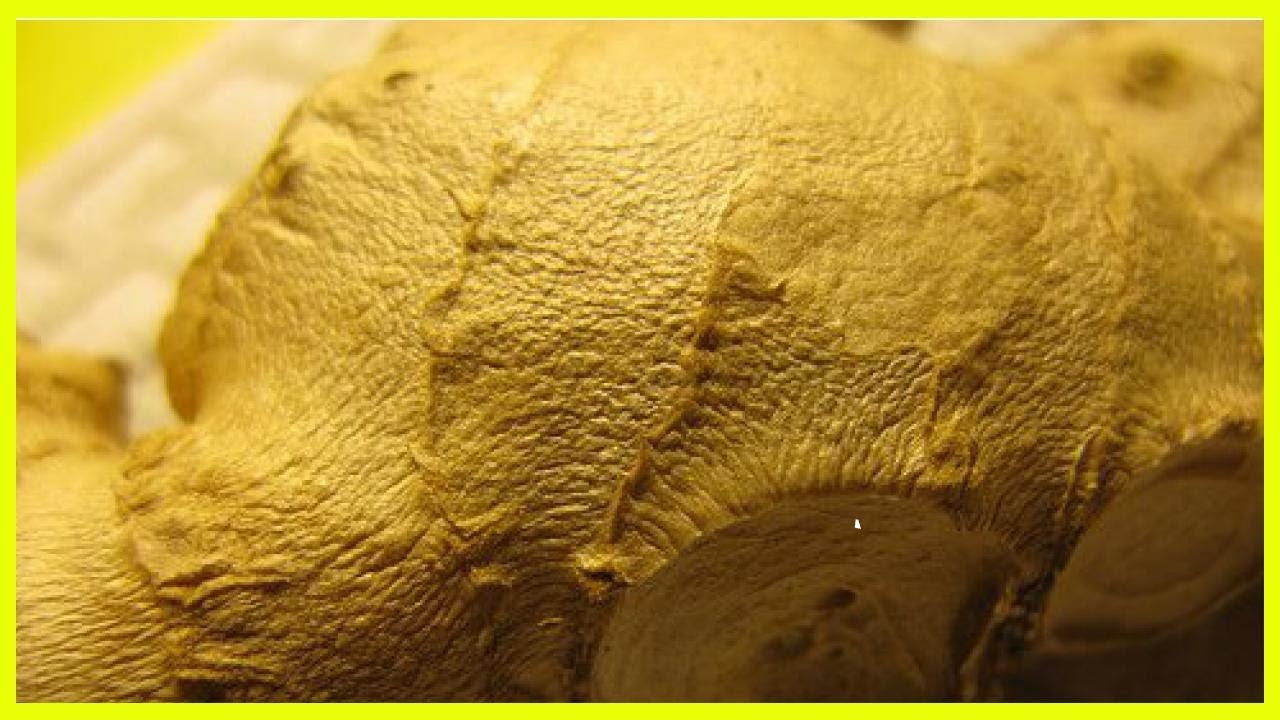 Home Remedies to Dissolve Kidney Stones