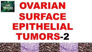 OVARIAN TUMORS -  Part 3 : ENDOMETRIOID, CLEAR CELL &amp; BRENNER TUMOR-  Pathology