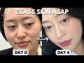 How I Got Glass Skin in 4 Days ✨ | Stem cell + Pigmentation Laser in Korea | Seoul Guide Medical