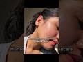 Best acne prone skincare routine- part 1 | #acneproneskin #acne #acnejourney