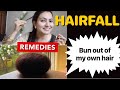 Hair Loss Treatment for Men & Women | Can we really Stop Hair Fall? | Preity प्रेरणा