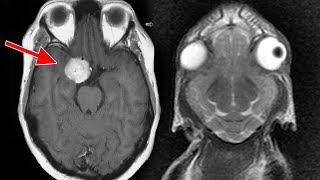 A Mom Drank 3 Gallons Water In 2 Hours to win a nintendo wii This is What Happened to Her Brain.