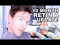 10 MONTH RETIN-A BEFORE AND AFTER | TRETINOIN CREAM