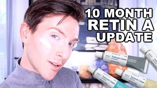 10 MONTH RETIN-A BEFORE AND AFTER | TRETINOIN CREAM