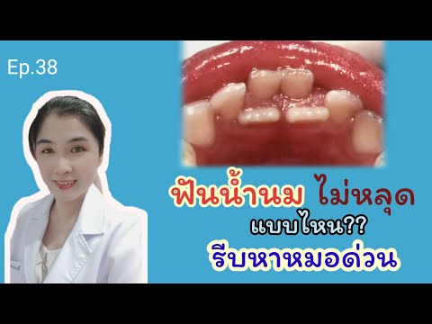 วีดีโอ: เมื่อฟันน้ำนมเปลี่ยนหมด