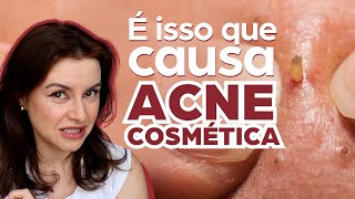 O que é acne cosmética? Como saber e como tratar acne cosmética?