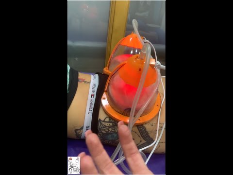 ცხიმის და ცელულიტის დამშლელი პროცედურები