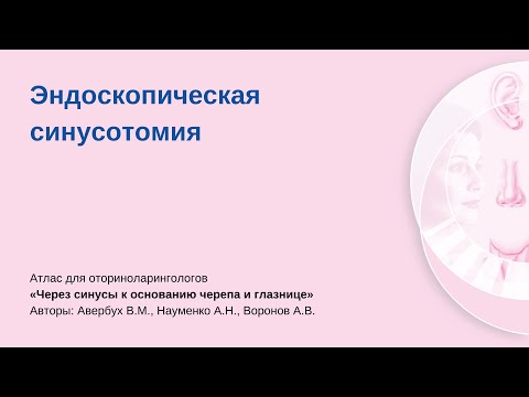 Эндоскопическая синусотомия. Операцию проводит Алексей Владимирович Воронов.