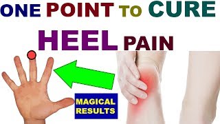 Sujok Therapy For Heel Pain/Acupressure Points For Heel Pain/Heel Pain Treatment In Hindi